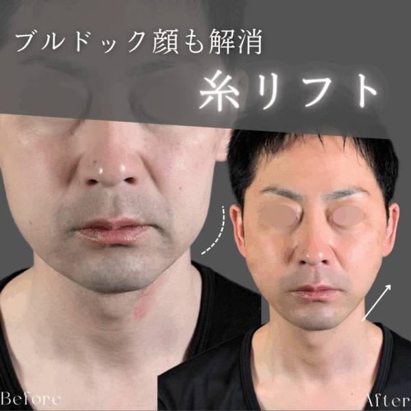 No.8873の症例写真